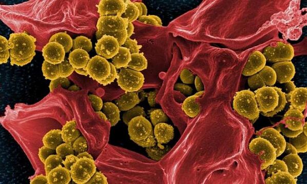 Staphylococcus aureus as a cause of bacterial prostatitis