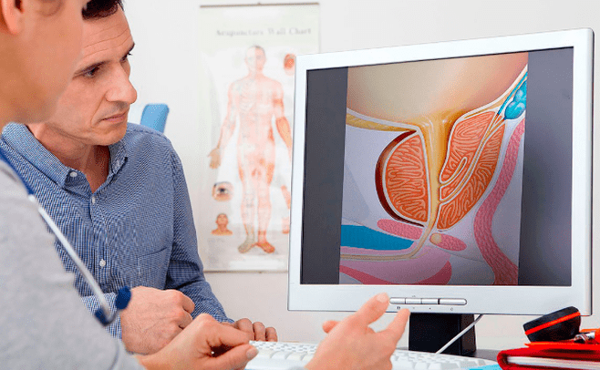 Prostatitis diagnosis